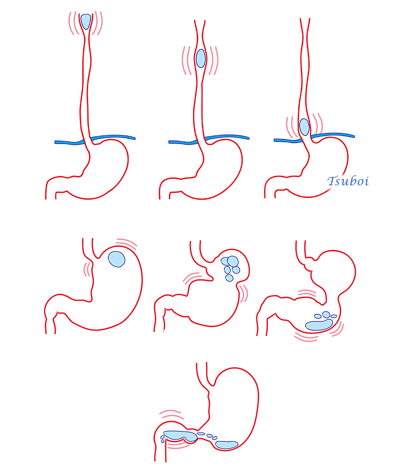 食道と胃のぜん動運動