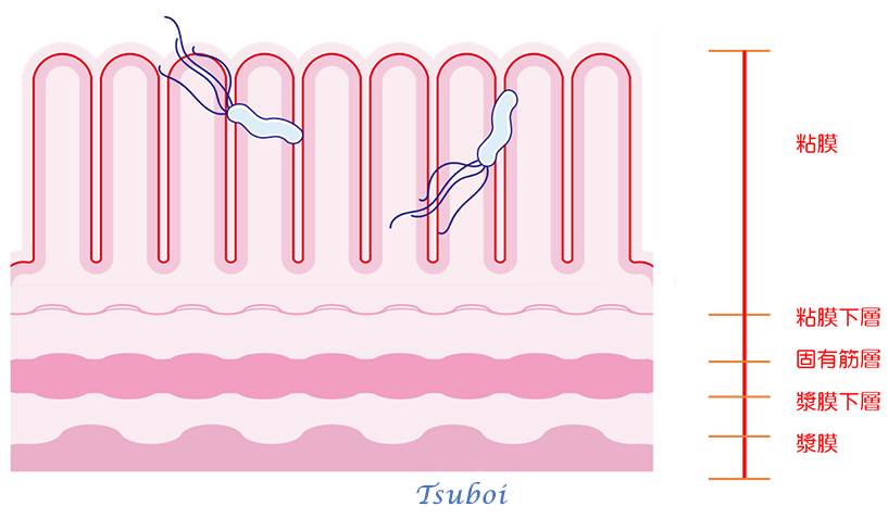 胃とピロリ菌