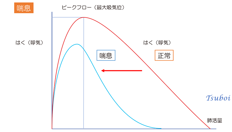 喘息