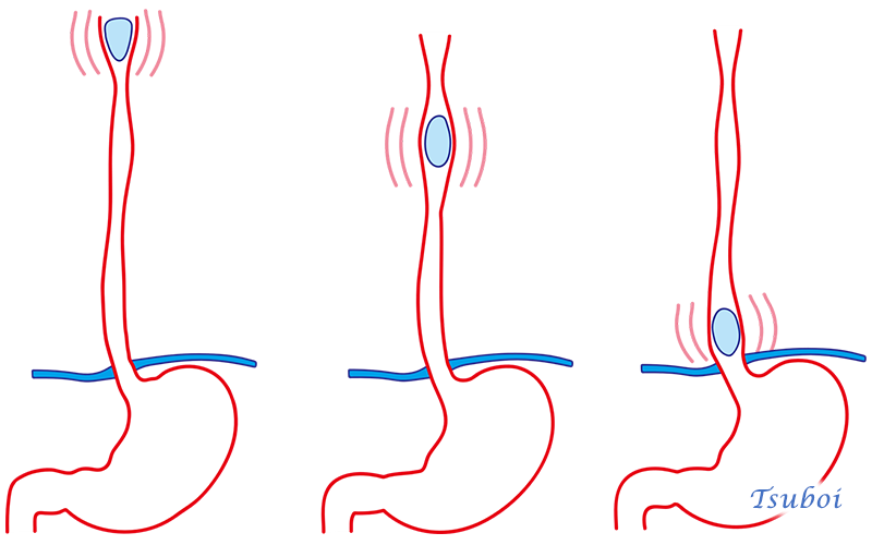 食道と胃のぜん動運動