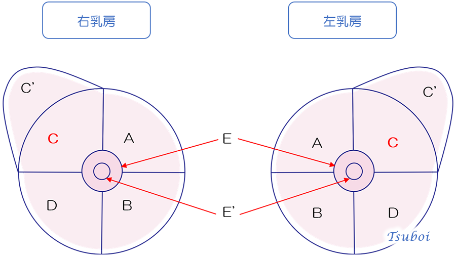 乳房超音波検査における領域